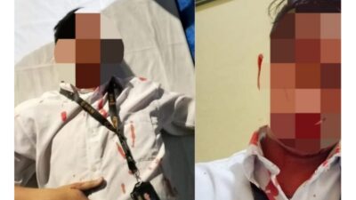 Pelaku Penikaman Karyawan Rich Club Kendari Masih Bebas, Korban Pertanyakan Komitmen Penegakan Hukum.