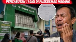 Pasien Minta Wali Kota Evaluasi: Program Gigi Gratis Linggau Juara Dinilai Tak Efektif